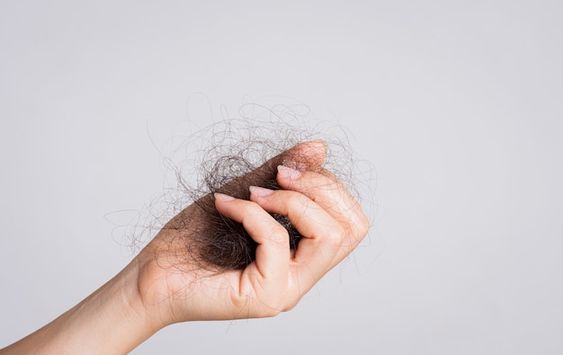 Hair loss treatment in Chennai