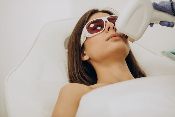 laser hair removal treatment