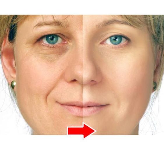 old age skin treatment