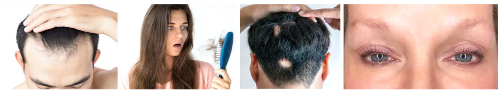 Hair thinning symptoms