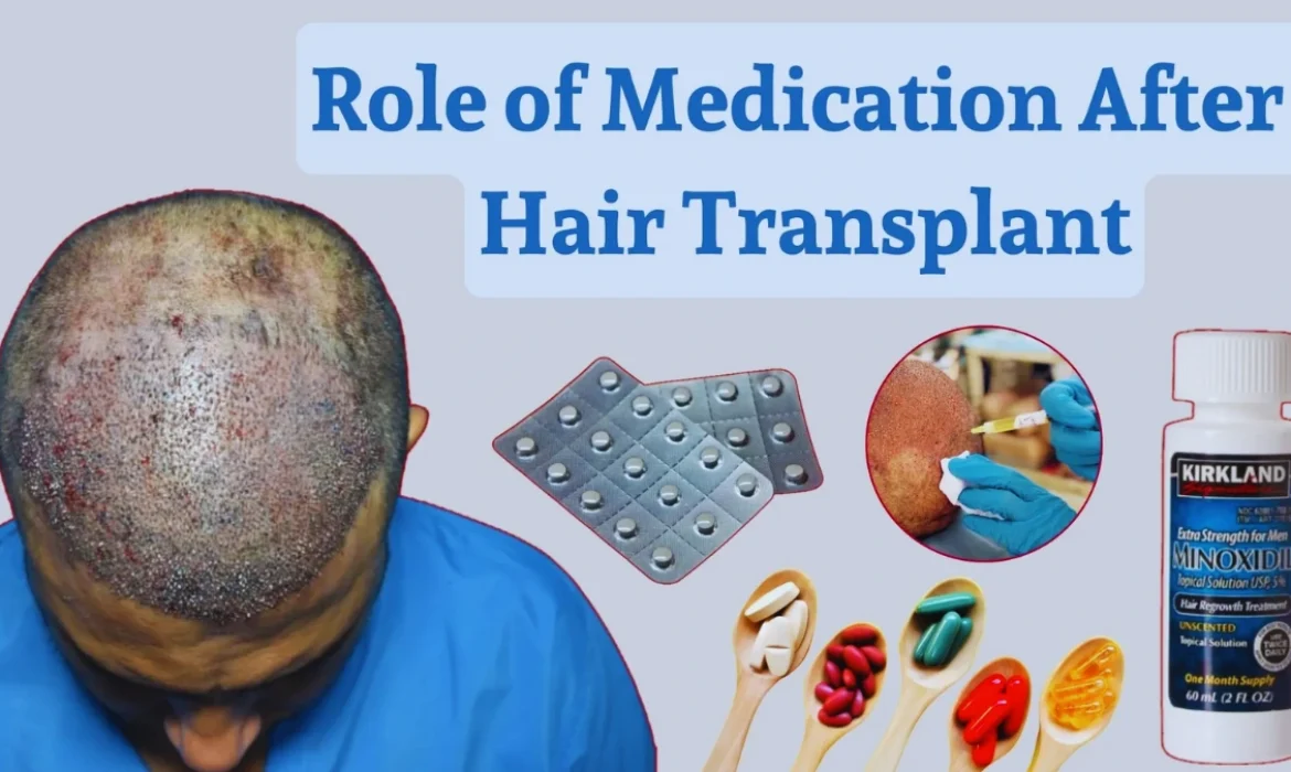 Medicine After Hair Transplant Essential Post-Operative Care for Optimal Results