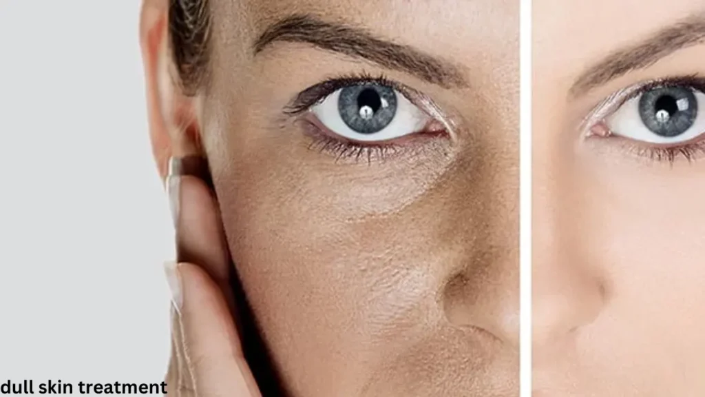 Dull Skin Treatment: How to Restore Your Natural Glow