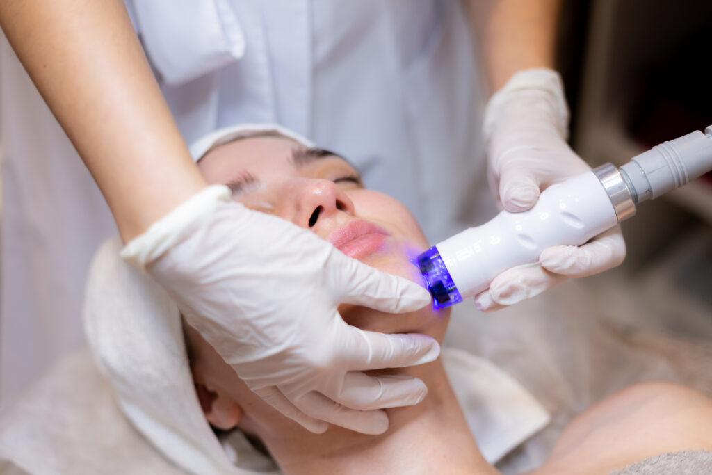 Laser Treatment for Scars: Benefits, Procedure & What to Expect
