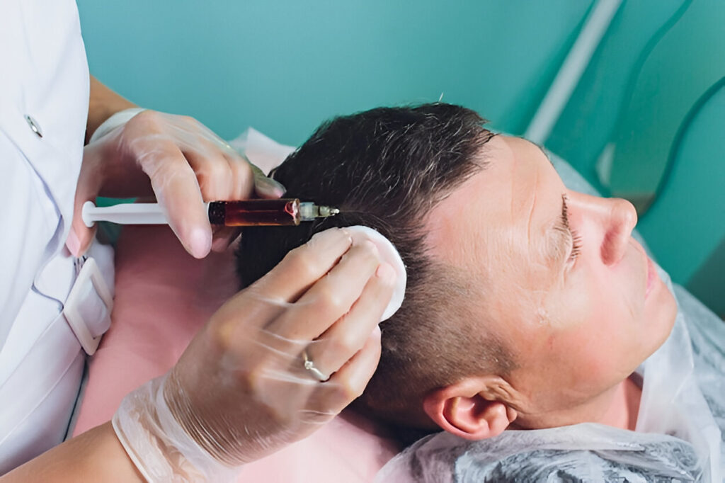 Hair Transplant Aftercare Tips: Ensuring Long-Term Results