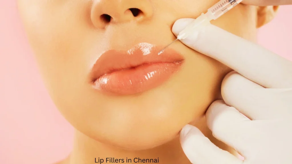 Lip Fillers in Chennai